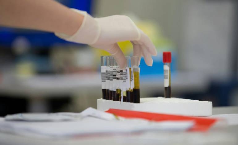 Blood test may predict lung cancer years in advance, study says
