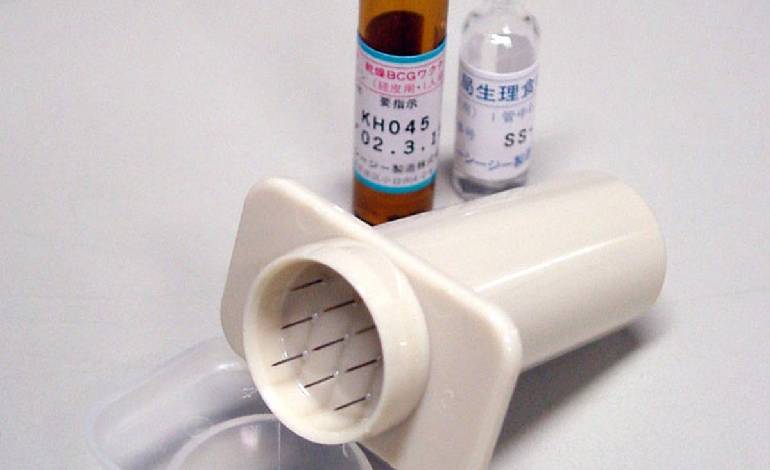 TB vaccine may hold clue to retrain immune system against Alzheimer’s, study finds