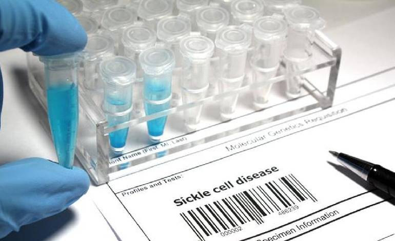 CSIR-CCMB develops India-specific tool to predict sickle cell severity